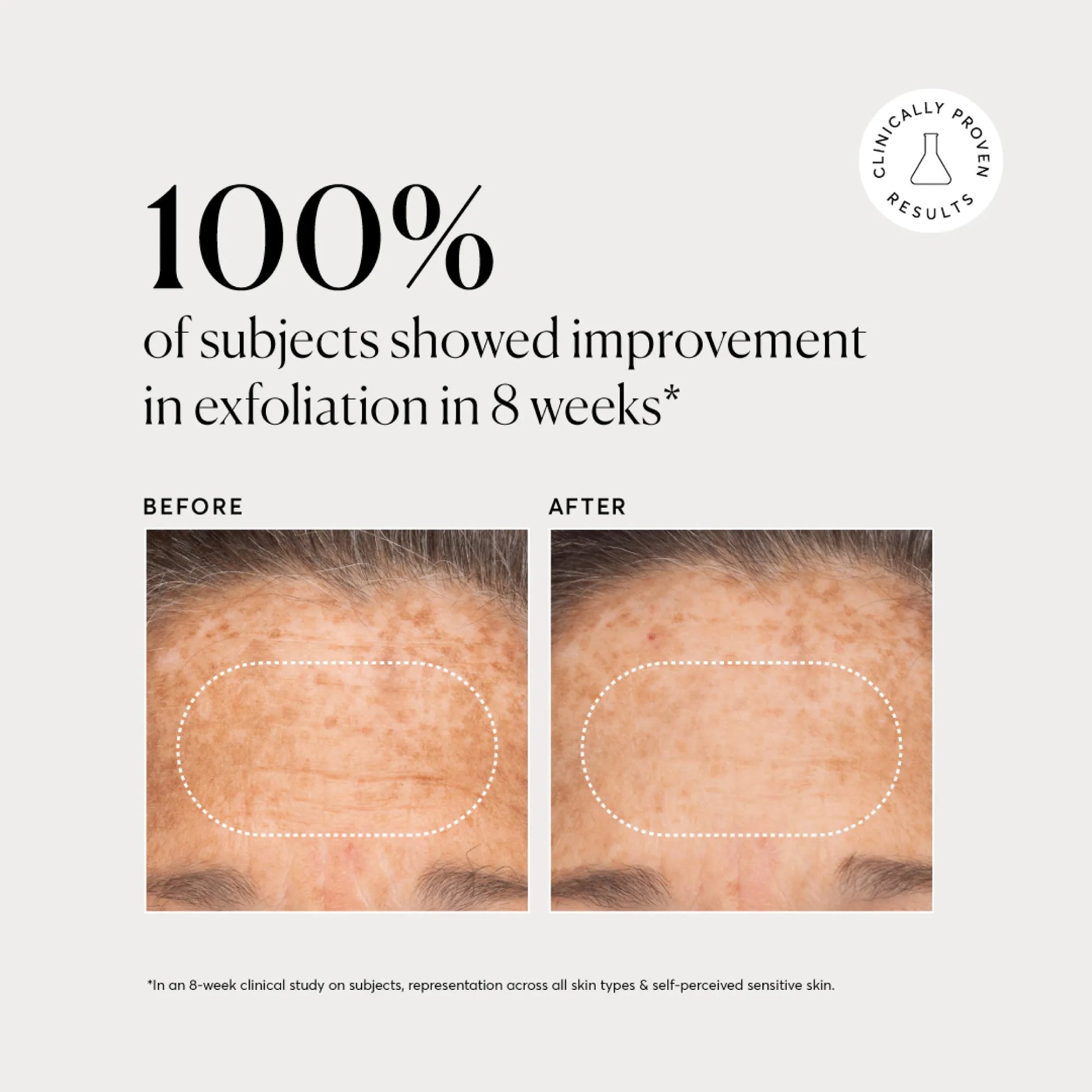 bha-liquid-exfoliant-2-t2 NATR-10027-Alt-Images-BHA-Liquid-Exfoliant-2_-03.webp
